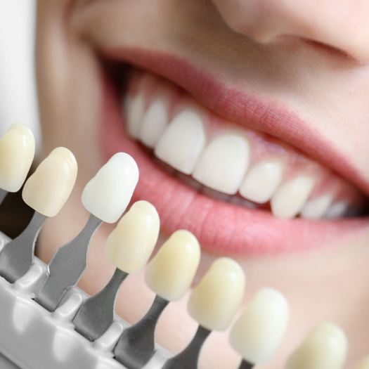 Smile enhancement dental care